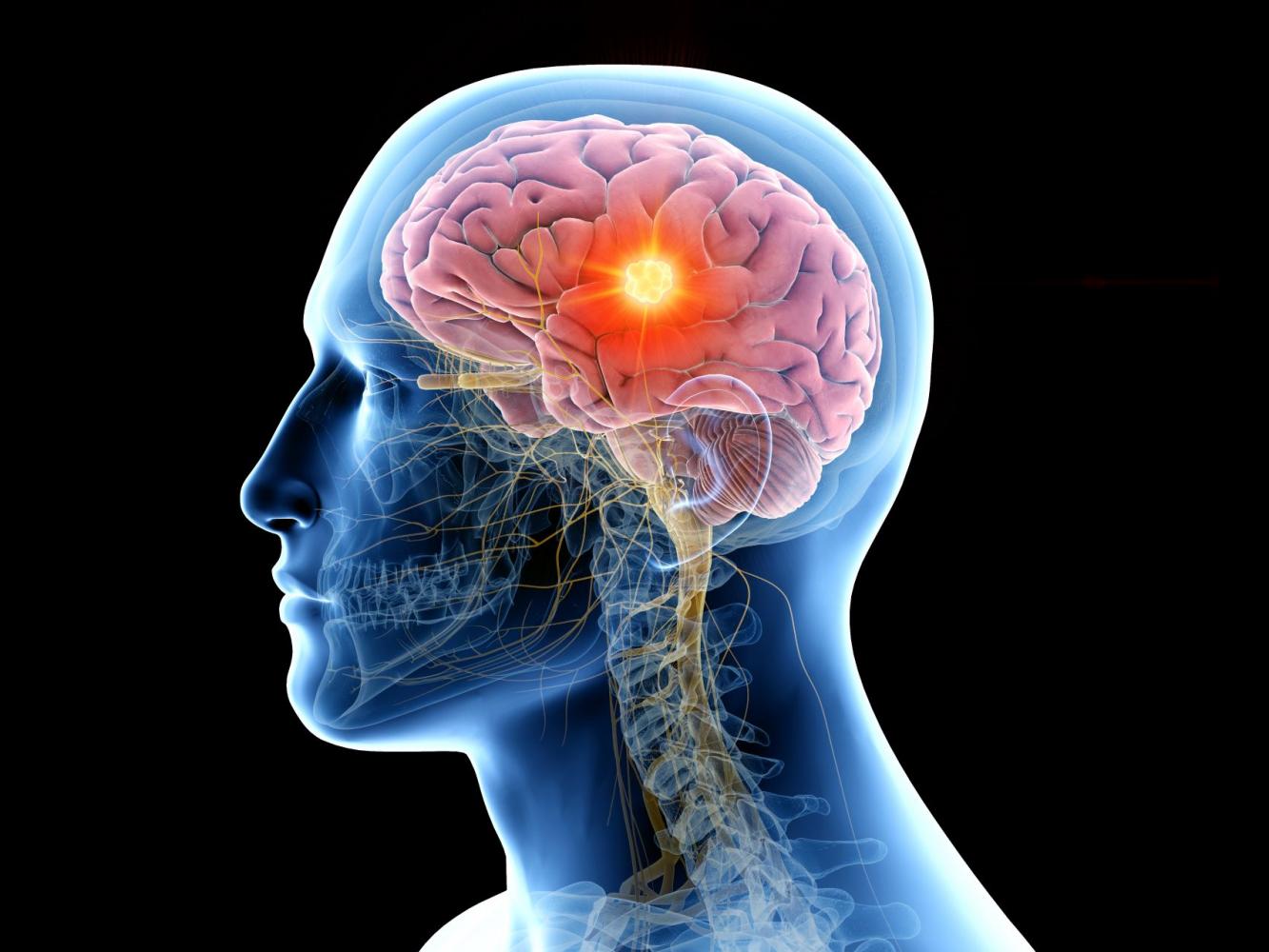 Illustration of side view medical imaging of brain and head