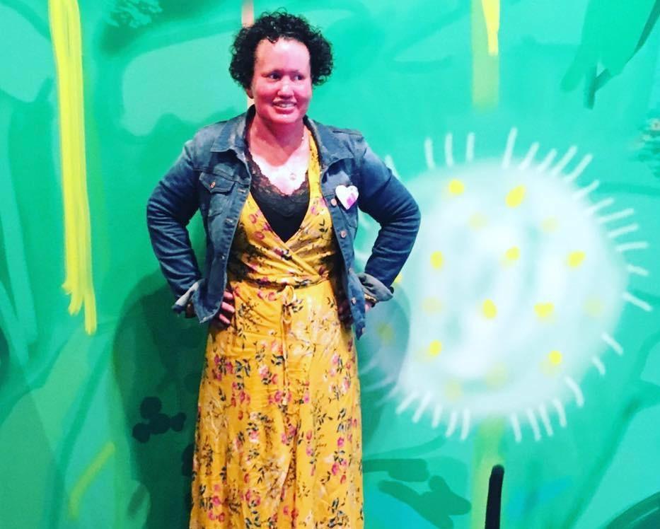 Carly posing, wearing a yellow dress and jean jacket